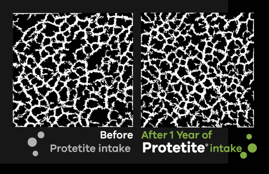 Comparison-bone-quality